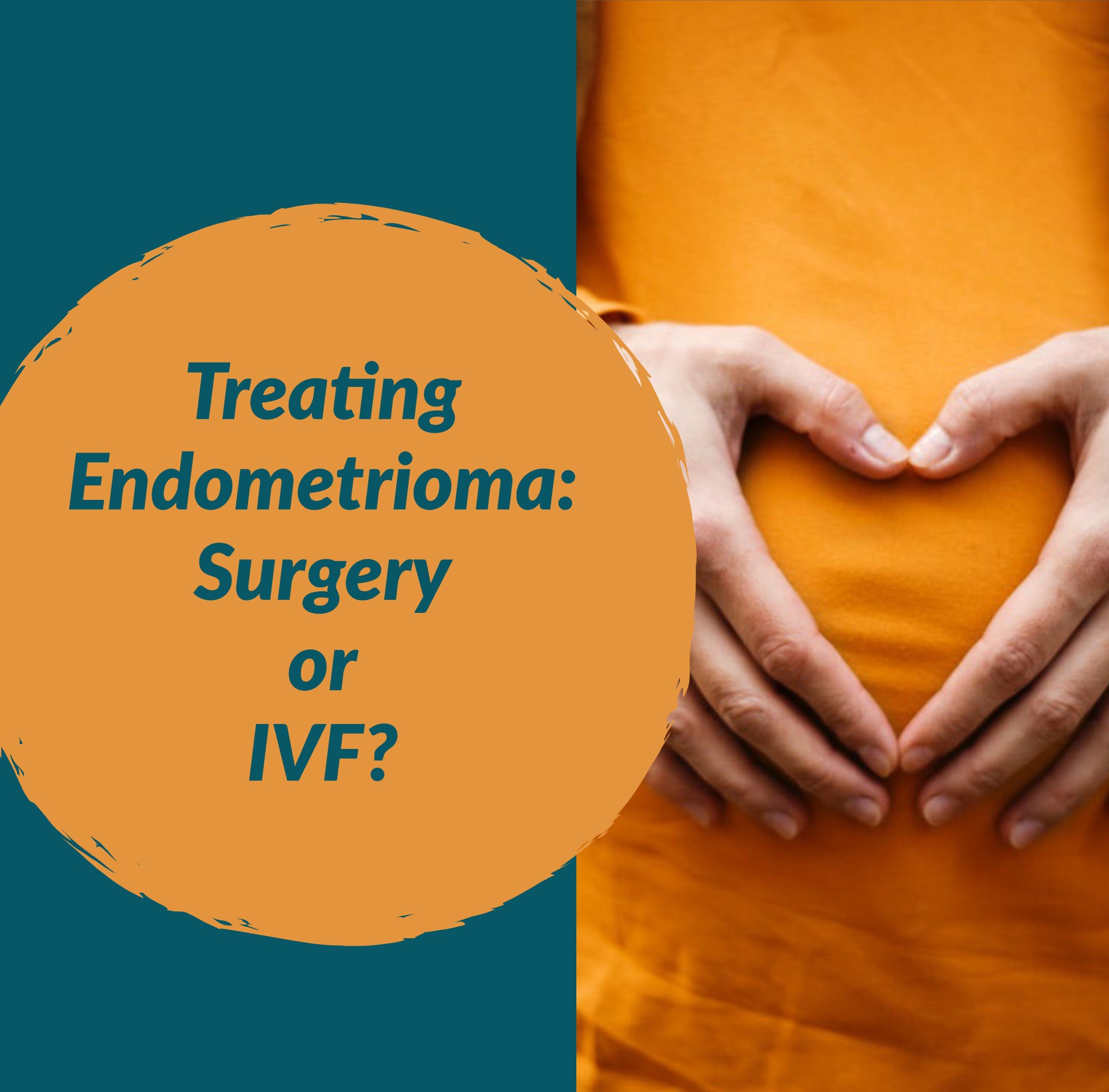 Ovarian Endometrioma Surgery or IVF?